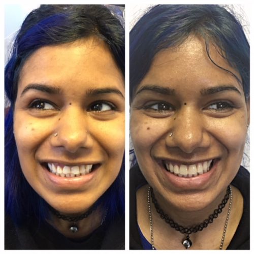 Before Dentist And After Dental Care